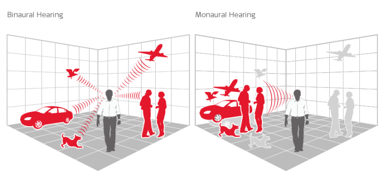 Binaural hearing with single-sided deafness