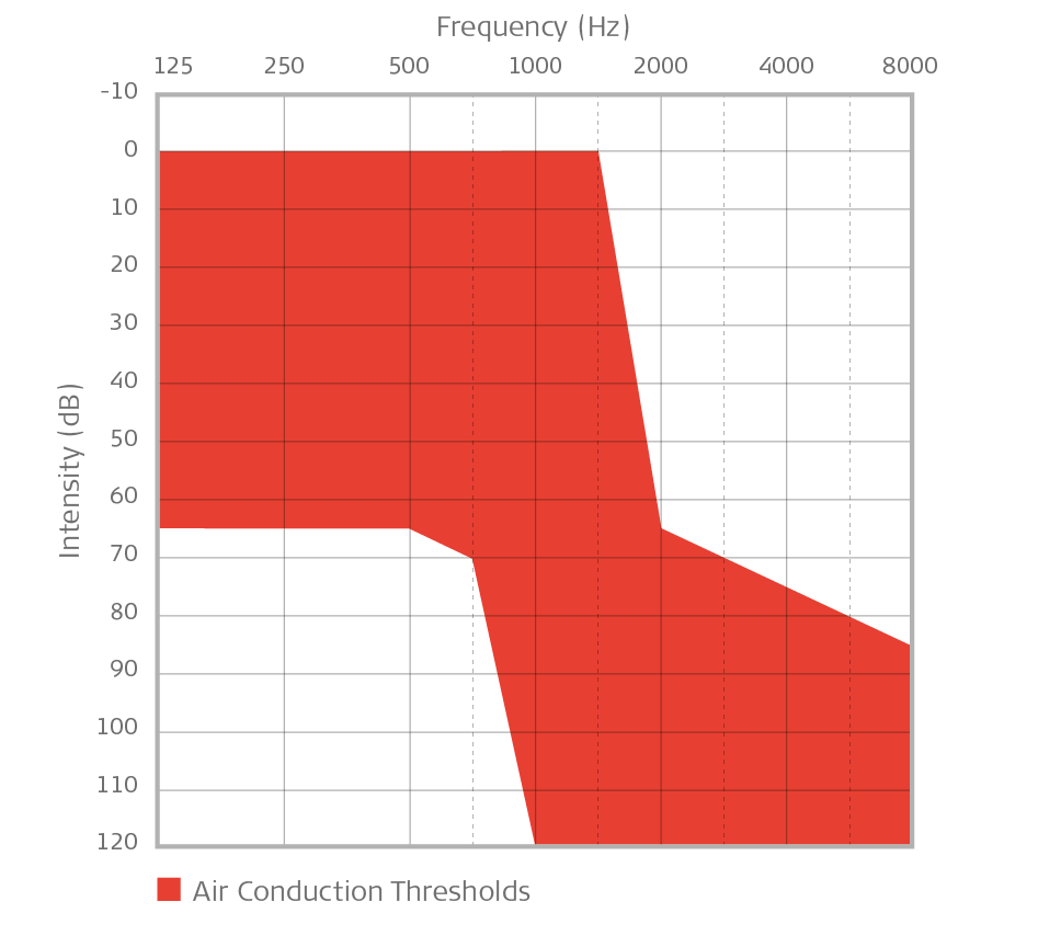 EAS Candidacy for High-Frequency Hearing Loss - MED-EL