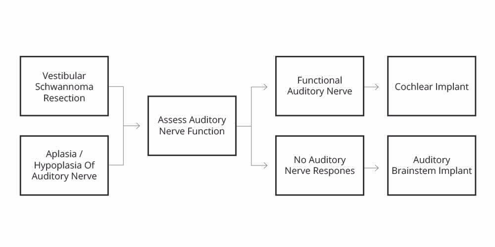 Auditory Brainstem Implant Decision 