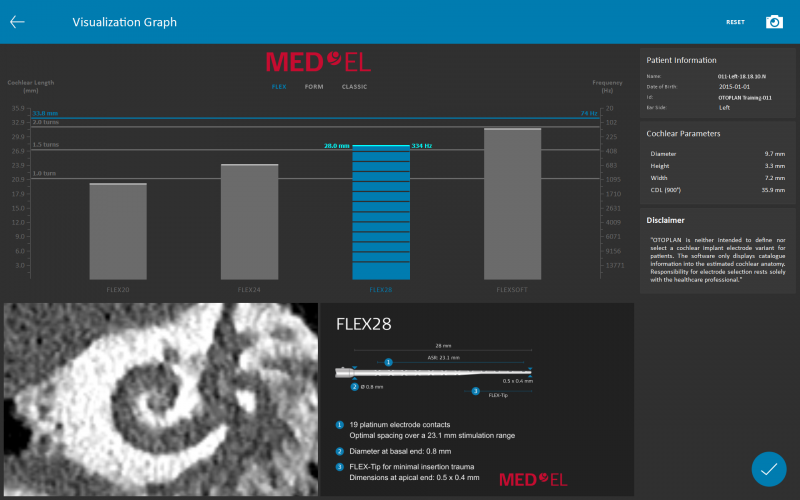 OTOPLAN Electrode Visualization Tool