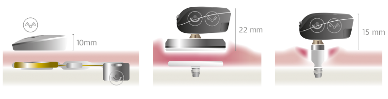 Bone Conduction Systems