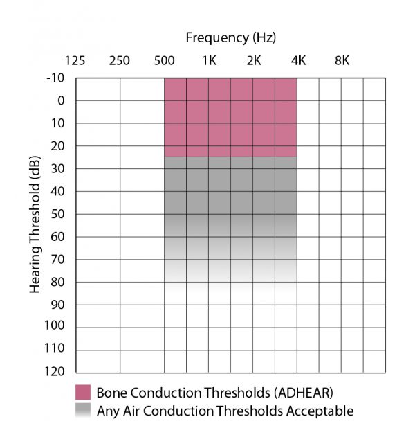 Bone conduction thresholds candidacy audiogram ADHEAR