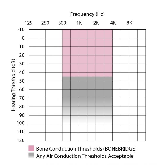 Bone conduction thresholds candidacy audiogram BONEBRIDGE