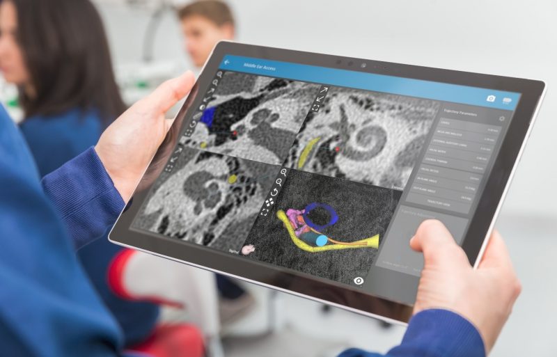 OTOPLAN virtual trajectory planning with OTOPLAN