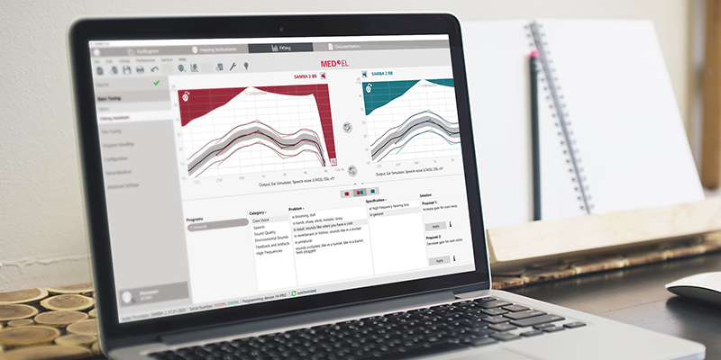 SYMFIT 8.0 has a really intuitive interface and workflow that audiologists will enjoy for first fits and follow-up.