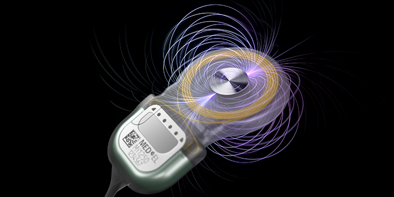 MRTs mit Cochlea-Implantat