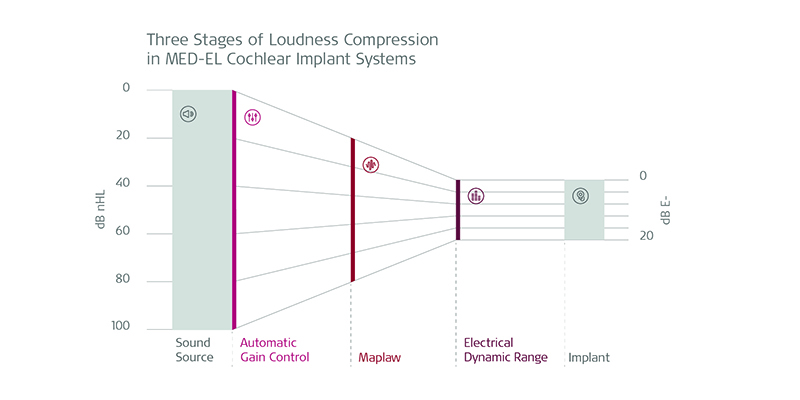 The three stages of compression in MED-EL cochlear implant systems