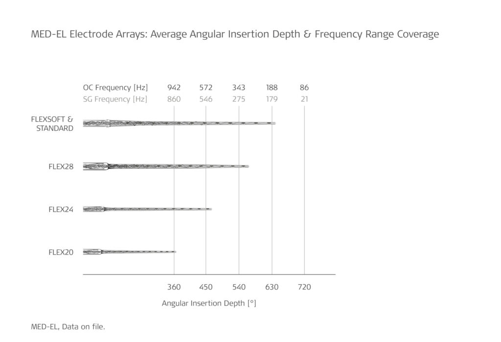 MED_EL Electrode Arrays: Average Angular Insertion Depth & Frequency Range Coverage Anatomy-Based Fitting