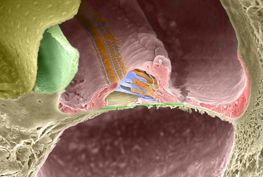 Cross section of cochlea