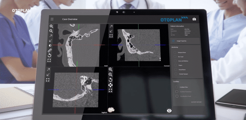 OTOPLAN otologic surgery