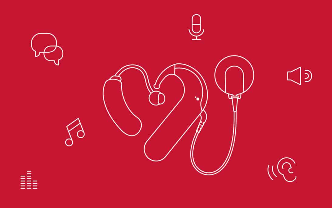 Bimodal rehabilitation with a hearing aid and a cochlear implant