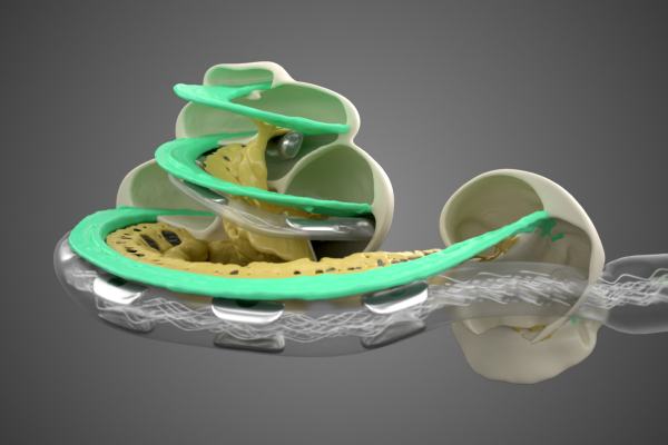 MED-EL Flex Electrodes