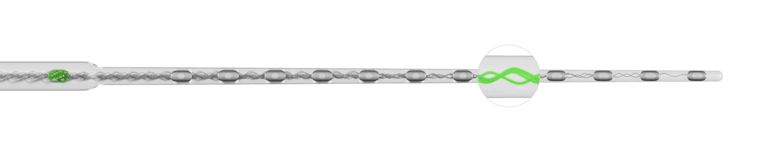 Erhalt des Restgehörs mit flexiblen Elektrodenträgern