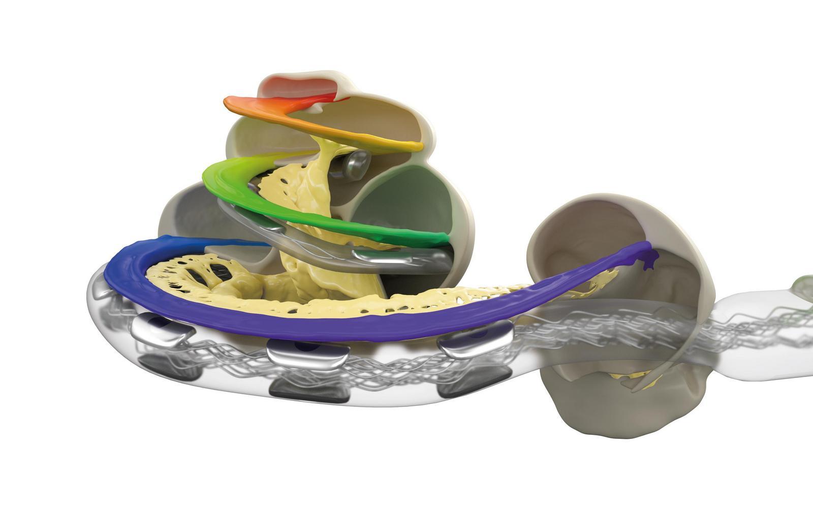 Anatomiebasierte Anpassung, Ratenkodierung und lange Elektroden sind erforderlich für ein möglichst natürliches Hören