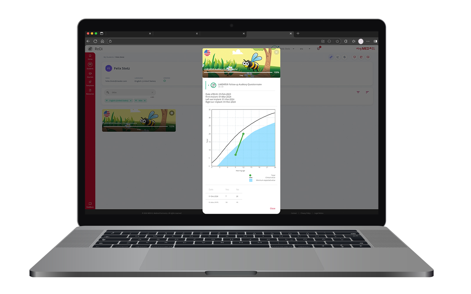 A laptop displaying a web interface with a medical or developmental assessment tool. In the center of the laptop screen, a vertical window shows the “LittleEARS® Follow-up Auditory Questionnaire” with a colorful banner featuring cartoon insects. Below the banner is a graph labeled with “Total score” and “Hearing age,” containing a curved expected‑value line, a shaded critical area, and a green line representing a total score. The surrounding interface includes navigation panels, buttons, and icons from the web platform hosting the assessment.