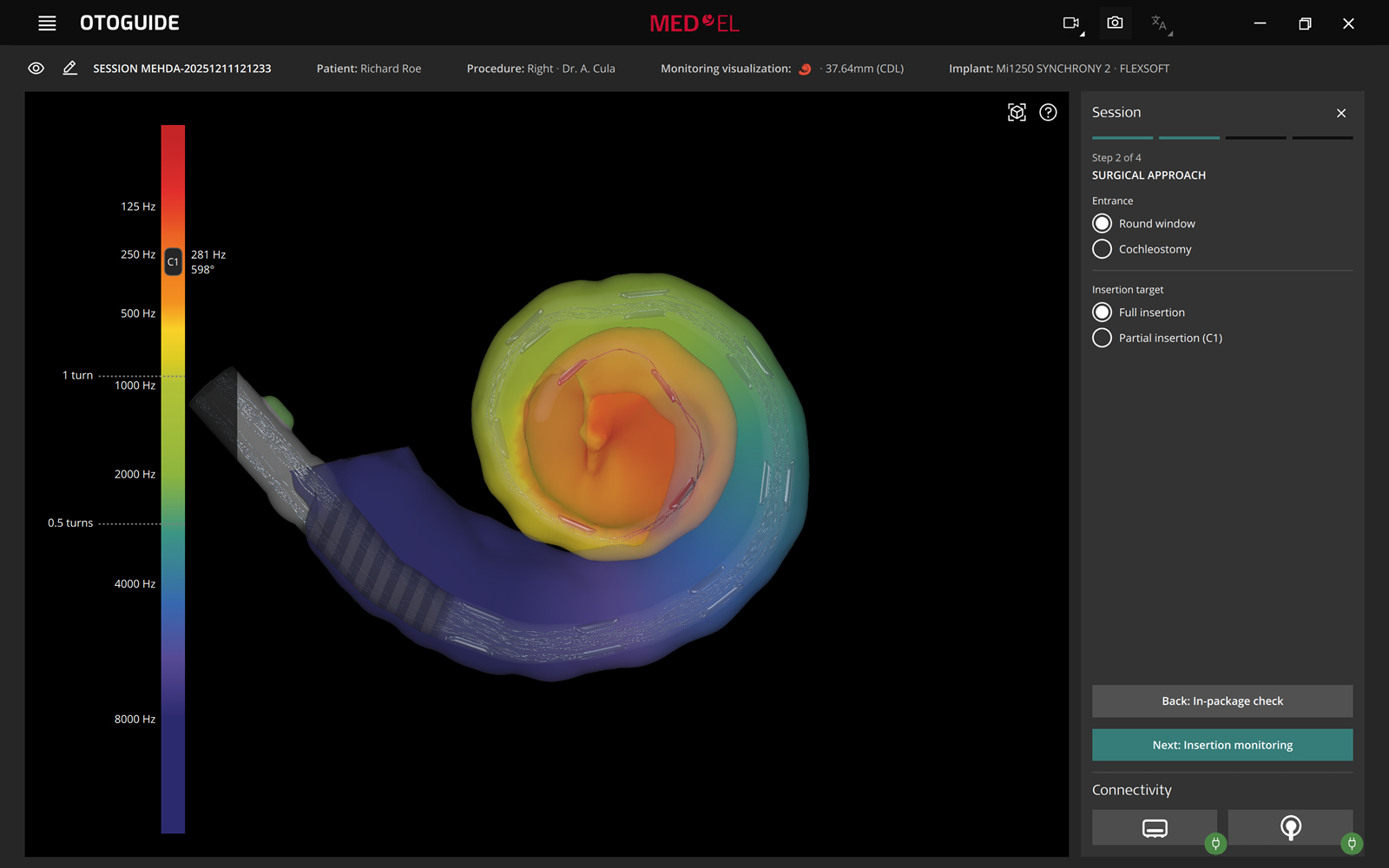 Patient-specific model of cochlea in OTOGUIDE