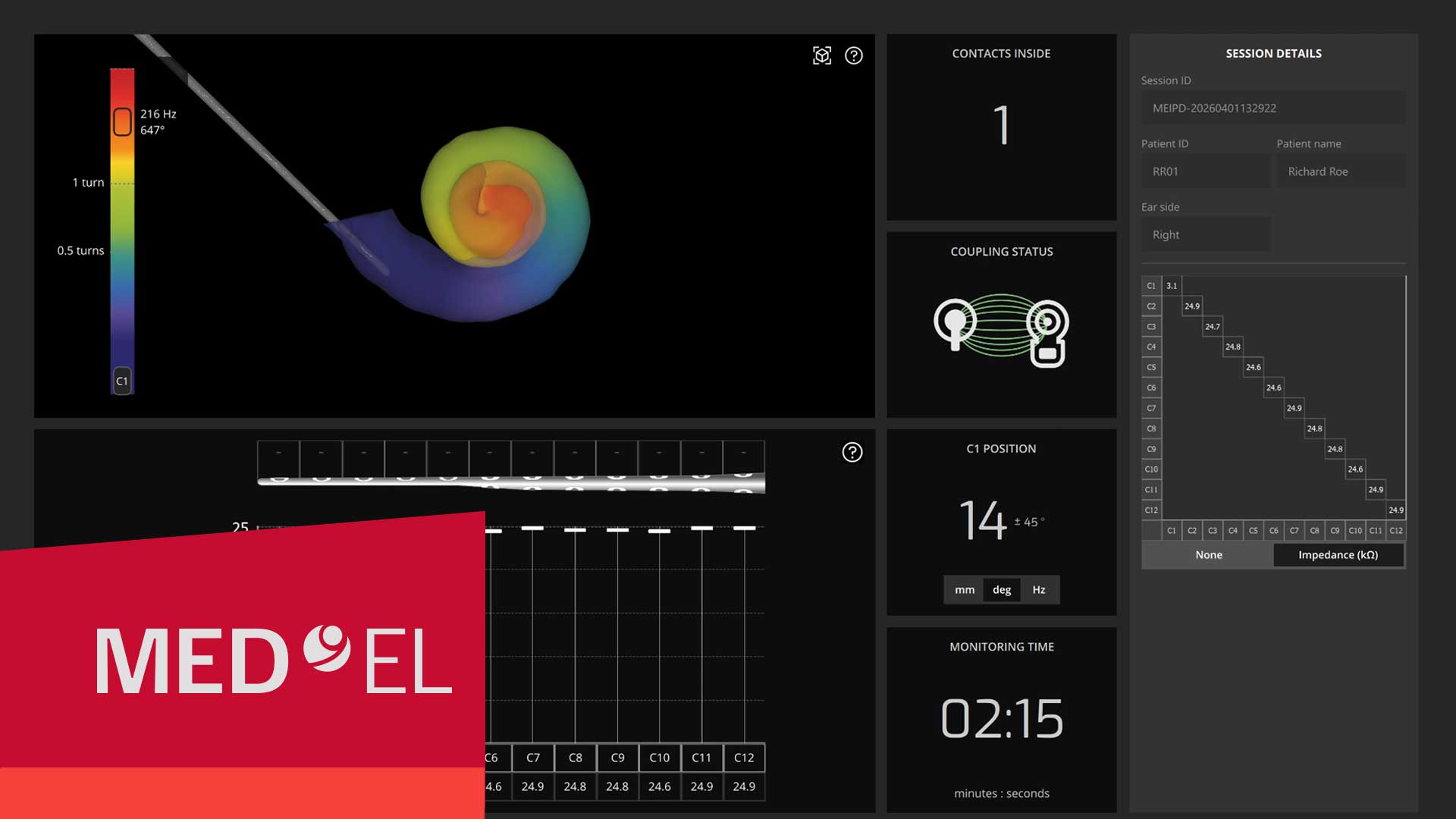 OTOGUIDE software for cochlear implantation