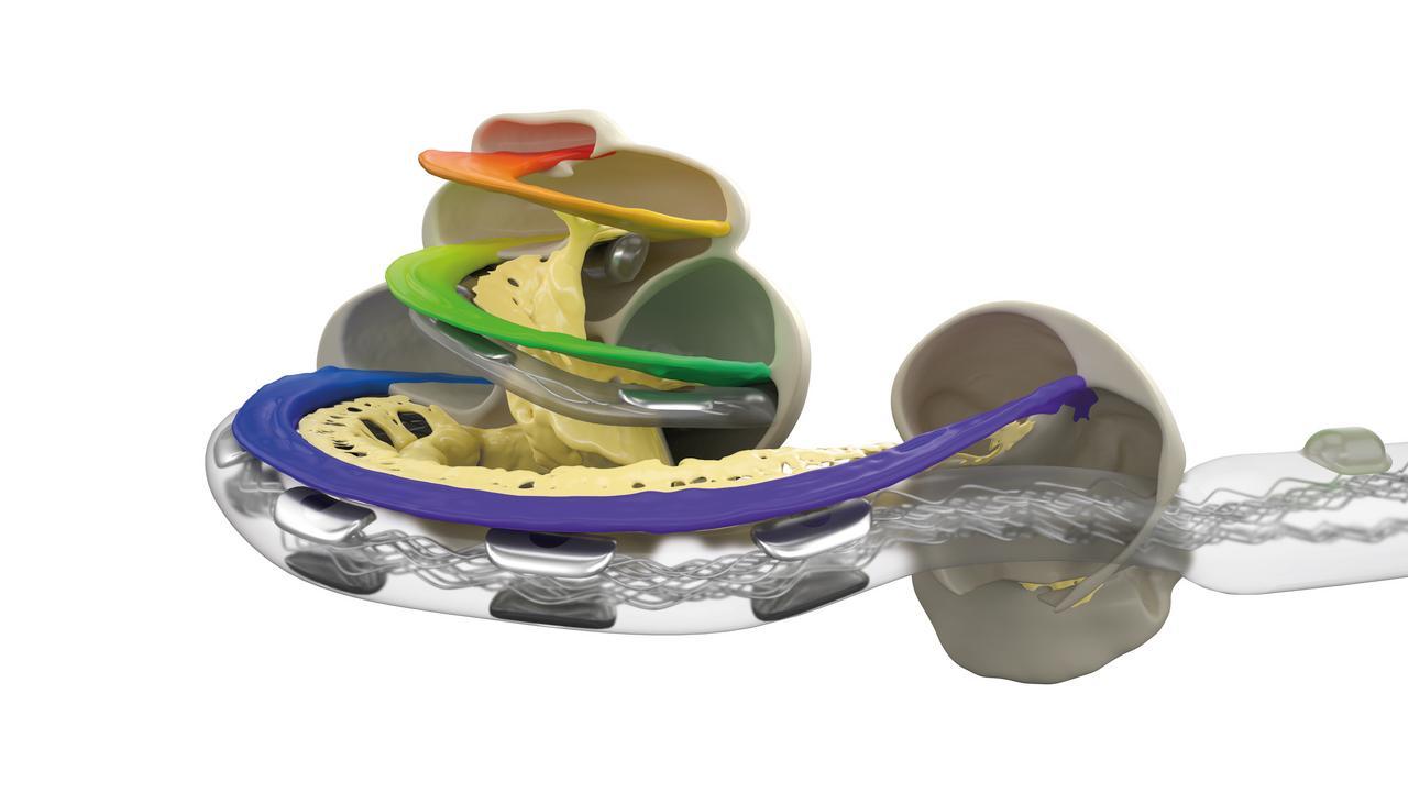 MED-EL cochlea display with rainbow highlight