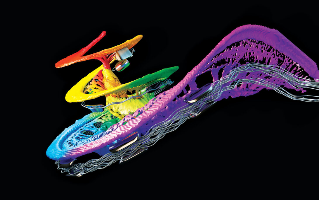 synchrotron imaging of cochlea
