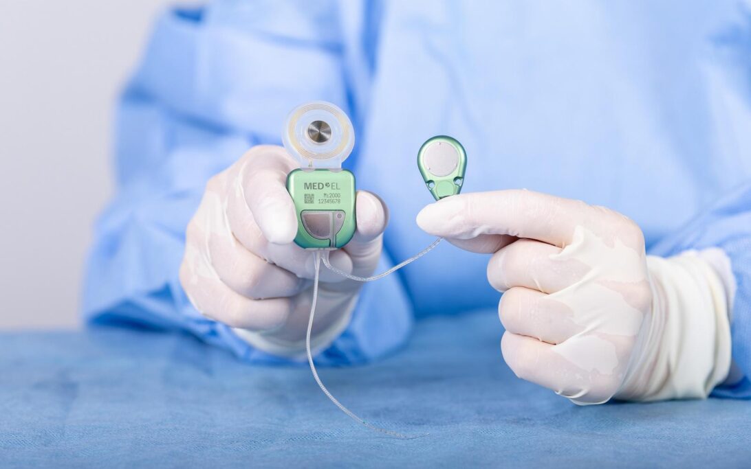 Close up of surgeon holding TICI UNICO implant in hands